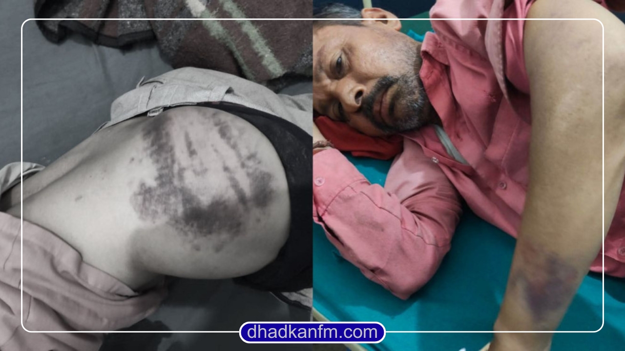 सर्लाहीमा एक पुरुषमाथि प्रहरीद्वारा कार्यालयमा थुनेर निर्घात कुटपिट